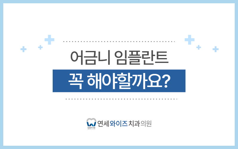 상도동치과 어금니 임플란트, 꼭 해야 할까요 다른 방법은 없을까요.jpg